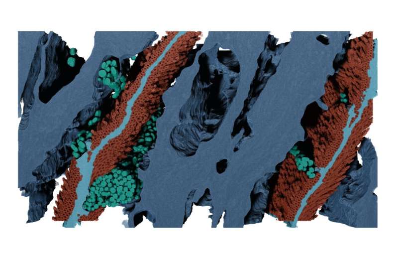 Mussel Byssal Threads: A Key to Rapid Release in Bio-Interfaces