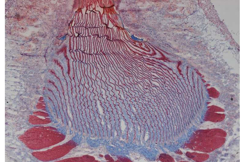 Mussel Byssal Threads: A Key to Rapid Release in Bio-Interfaces
