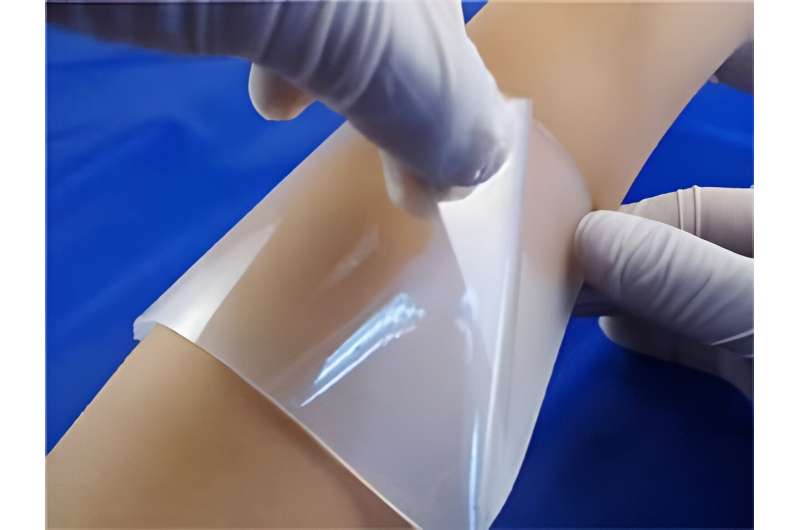 Hydrogel Wound Dressings: A Promising Alternative for Faster Healing