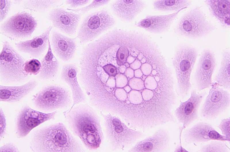 hnRNPM Protein Safeguards Protein Production Integrity - Research