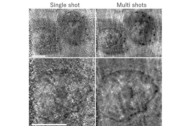 High-Speed Soft X-ray Imaging of Mammalian Cells