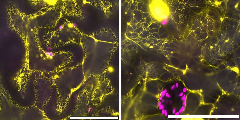 Ancient Protein Reveals Insights into Plant Cell Structure