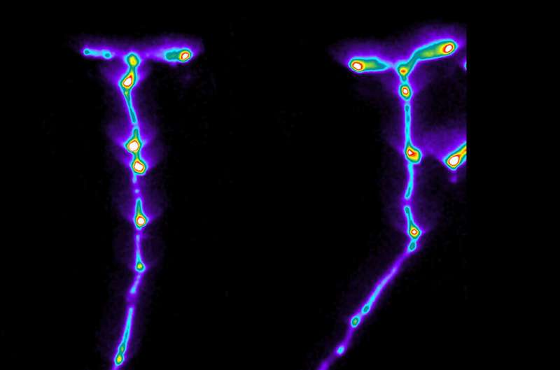 Autophagy and Plant Root Growth: Research Reveals Key Mechanisms