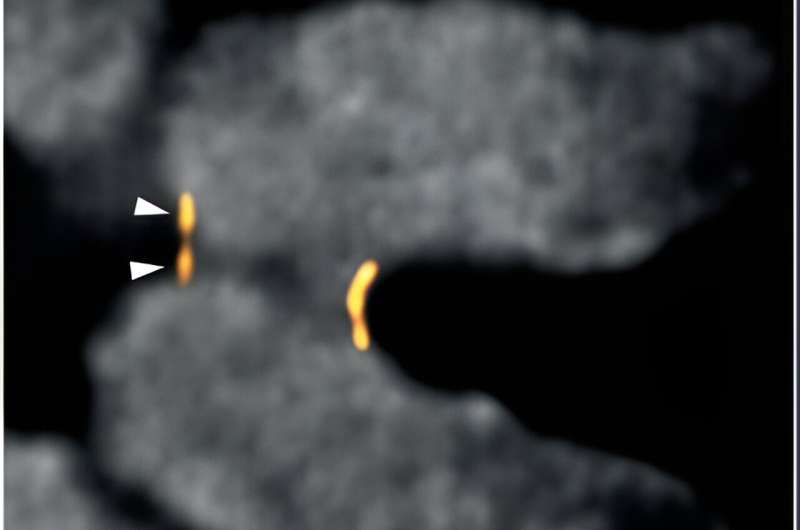 Centromere Research Uncovers Mechanisms of Chromosome Segregation Errors