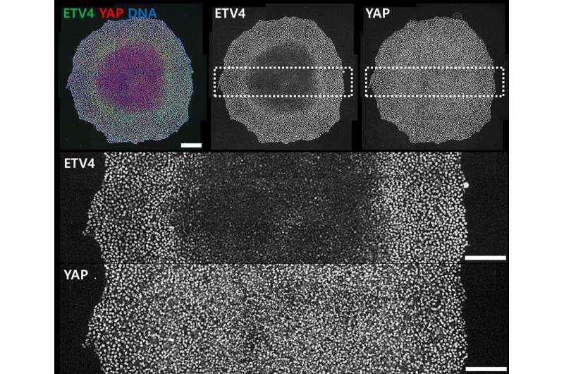 Novel Cellular Transducer Discovered: How Cells Sense Mechanical Forces