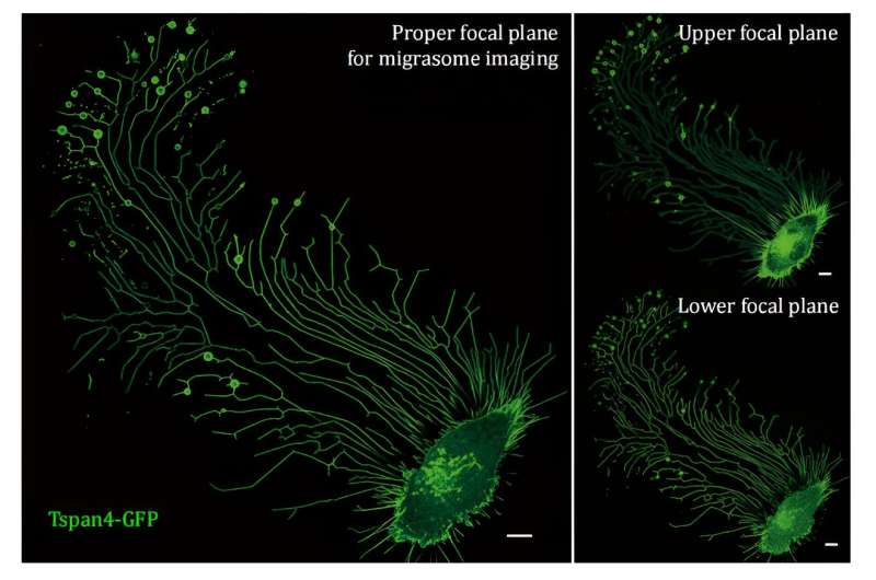Migrasomes: A Confocal Microscopy Study of Tetraspanin4-GFP Overexpression