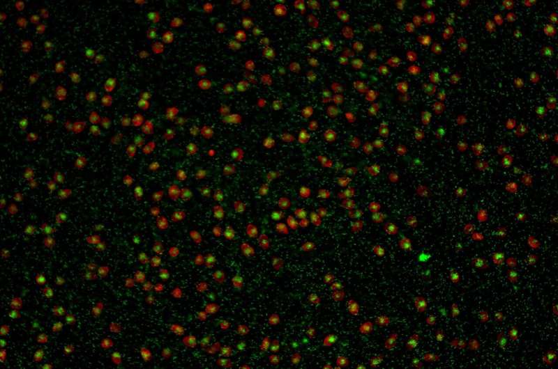 Microscopic Predators: Amoebae and the Costs of Hunting