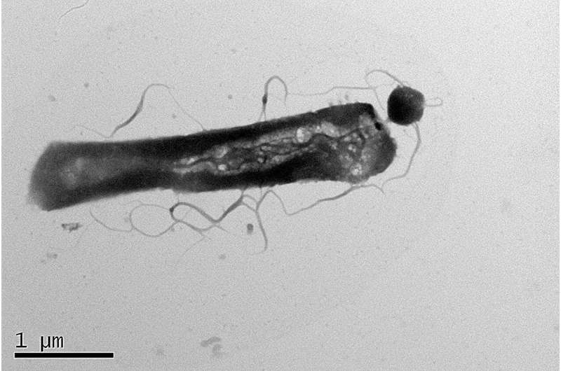 Parasitic Archaea Manipulate Host Metabolism – New Research Reveals