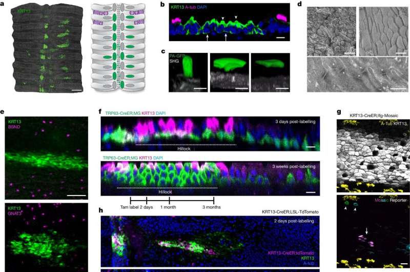 Airway Hillocks: A Novel Discovery Reshaping Lung Biology