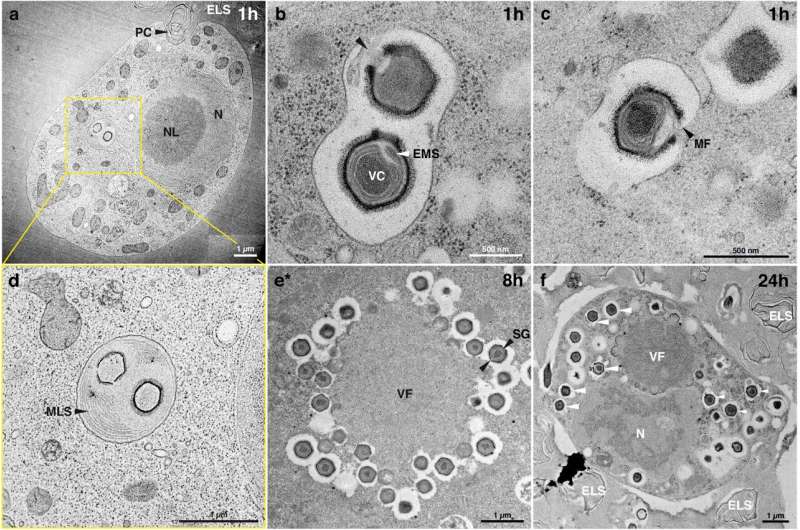 Giant Virus Found Infecting Deadly Parasite in Wastewater