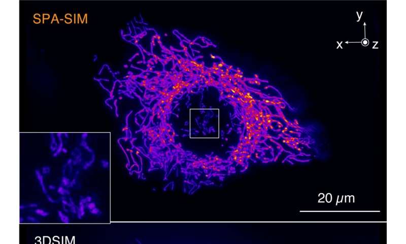 Selective Plane Activation (SPA-SIM) Microscopy for High-Resolution Cell Imaging