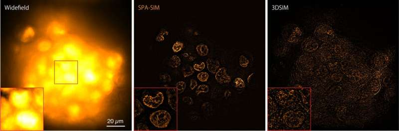 Selective Plane Activation (SPA-SIM) Microscopy for High-Resolution Cell Imaging