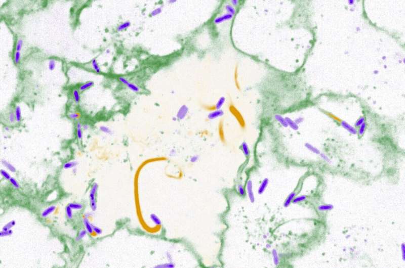 Unseen Spread: How Pathogens Evade Detection Within the Body