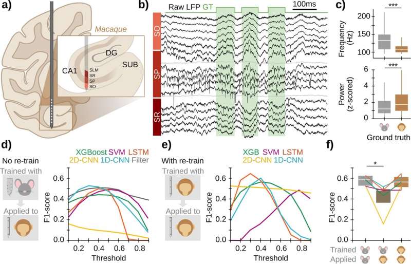 AI Models Identify Memory Formation Signals in the Brain
