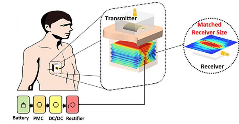 Ultrasound Wireless Charging for Implantable Medical Devices: A Breakthrough in Power Transfer