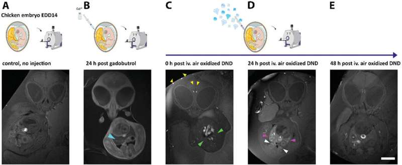 Diamond Dust as a Novel MRI Contrast Agent: A Gadolinium Alternative