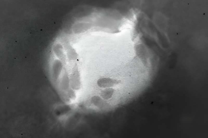 Nanoparticle Therapy: Targeting COVID-19 Variants with Spike Protein Innovation