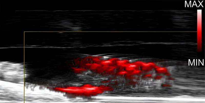 Gold Nanoparticles: A Novel Antibacterial Solution Without Antibiotics