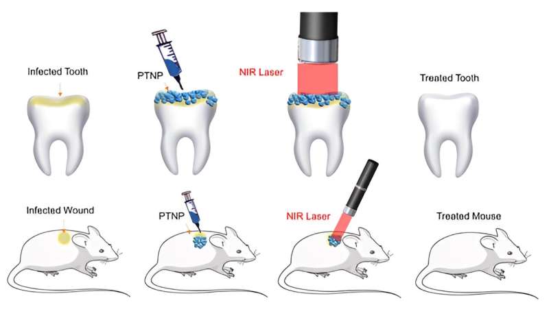 Gold Nanoparticles: A Novel Antibacterial Solution Without Antibiotics