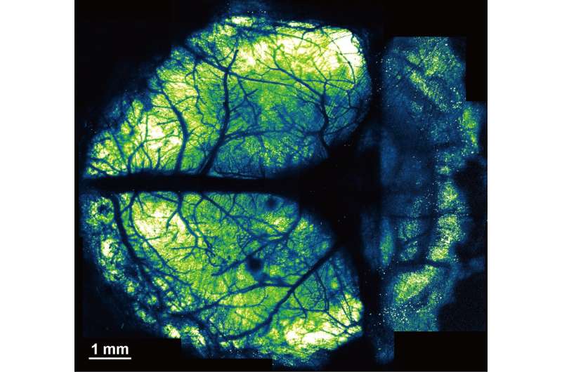Novel Nanosheet Method Enables Long-Term Brain Imaging in Mice