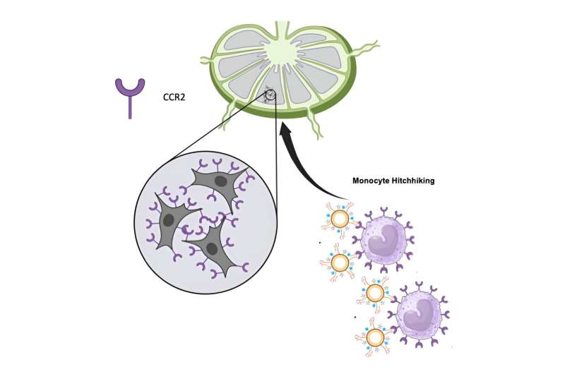 Early Cancer Detection: Nanoparticles Track Metastasis via Immune Cells