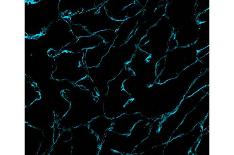 Nanoscale Brain Cancer Imaging Breakthrough with dExPath Microscopy