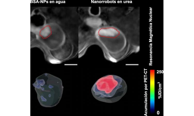 Urea-Powered Nanorobots Eradicate Bladder Tumors in Mouse Study