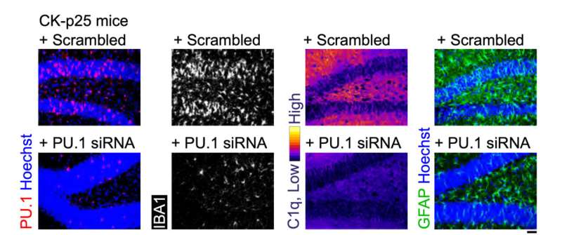Nanoparticle-Delivered RNA Shows Promise in Reducing Neuroinflammation