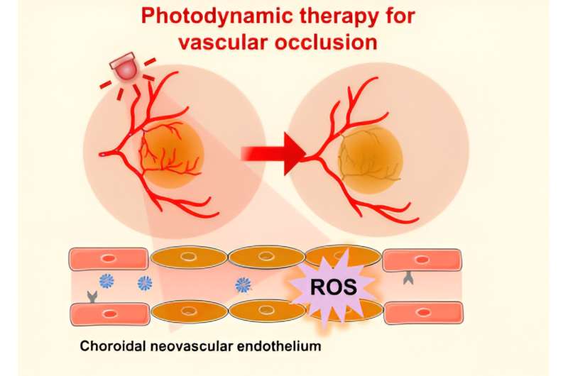 Novel Nanomedicine for Age-Related Macular Degeneration Using Light-Activated Therapy