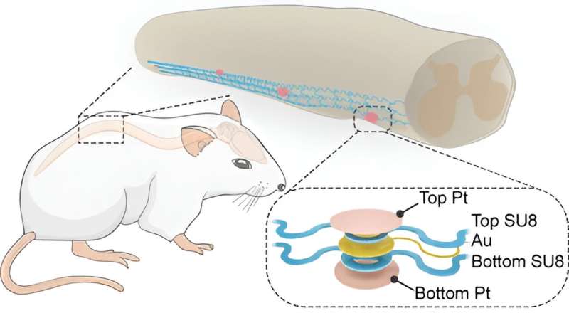 Revolutionary Spinal Stimulator Shows Promise for Paralysis Treatment