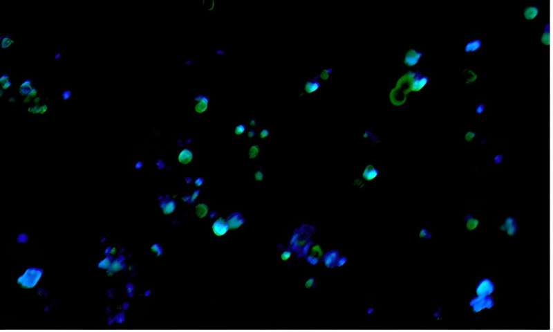 Biohybrid Microrobots for Microplastic Removal: A Promising Solution for Aquatic Pollution