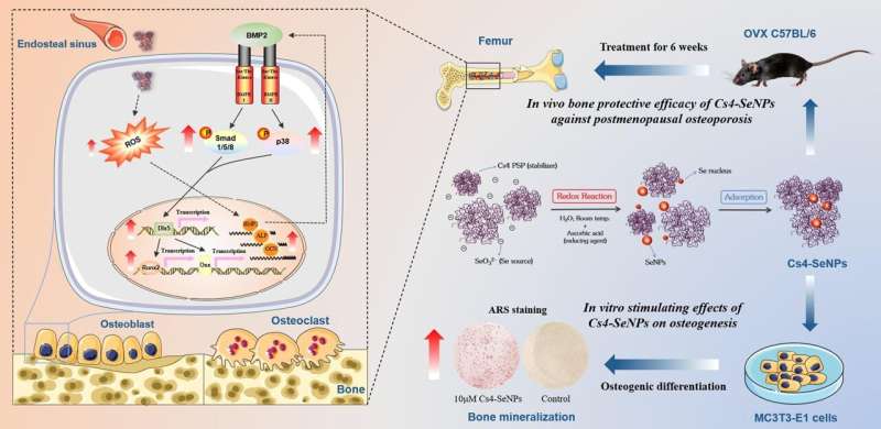 Selenium Nanoparticles Show Promise in Treating Postmenopausal Osteoporosis