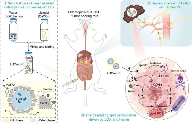 Lipiodol Microreactors for HCC Therapy: A Novel Approach with Nano-CaCO₃