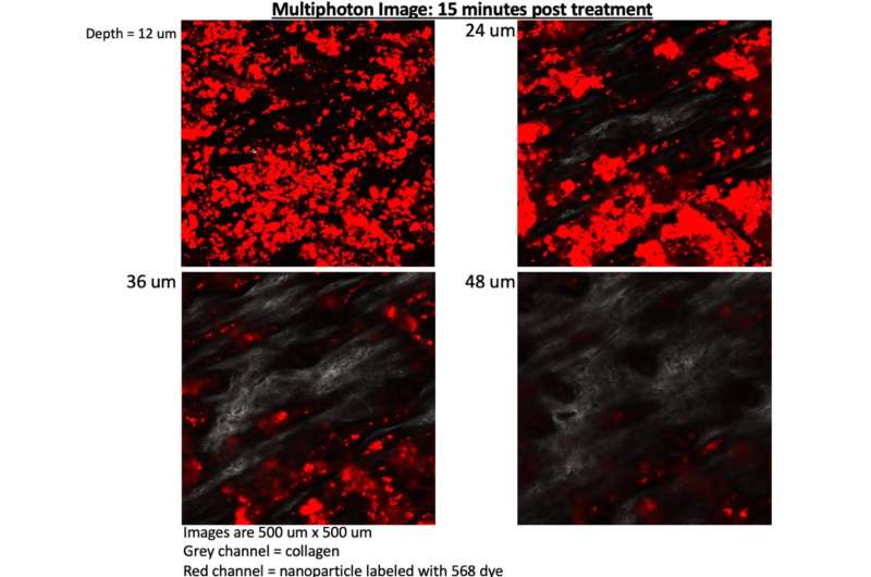 Bliss Compound Shows Promise for Treating Autoimmune Skin Disease