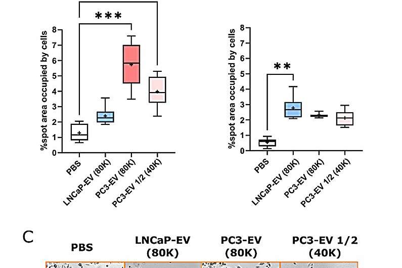 Agarose Migration Assay: Uncovering Extracellular Vesicle Roles in Cancer Metastasis