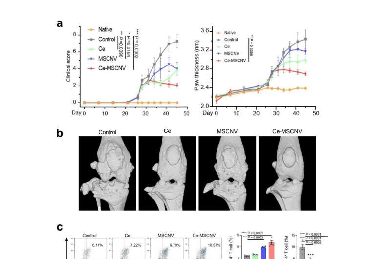 Nanoparticles Show Promise in Treating Rheumatoid Arthritis