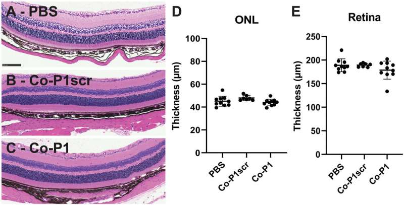 Protein Polymers Show Promise in Macular Degeneration Therapy