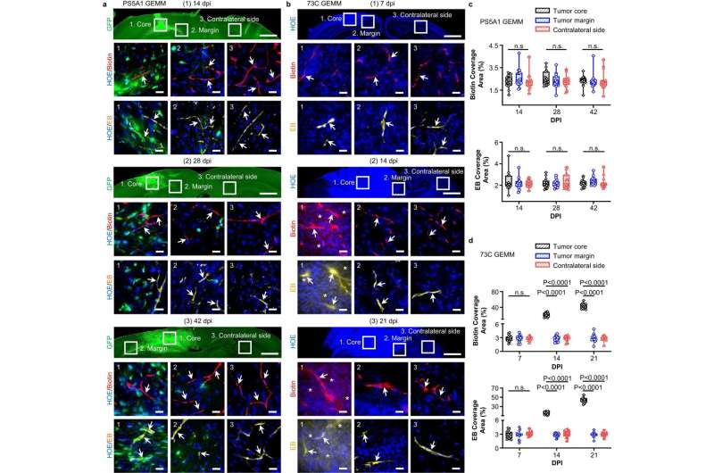Vessel-Targeted Gold Nanoparticles for Brain Cancer Drug Delivery: A Promising Approach