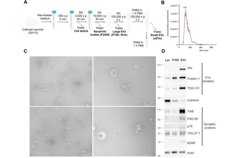 Extracellular Vesicles (EVs) in Neurodegenerative Disease: A Novel Therapeutic Approach