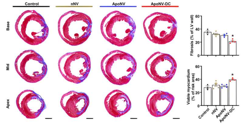 Nanovesicle Therapy Shows Promise in Treating Myocardial Infarction