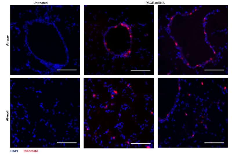 mRNA Nanoparticles for Lung Therapeutics: A New Approach to Respiratory Disease