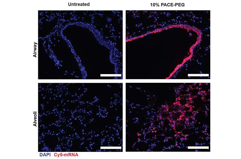 mRNA Nanoparticles for Lung Therapeutics: A New Approach to Respiratory Disease
