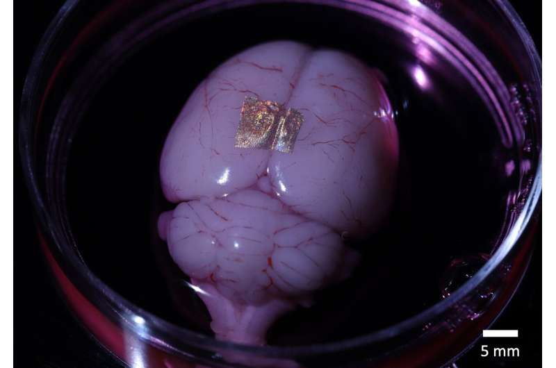 Nanoscale Cell Tattoos for Early Health Detection