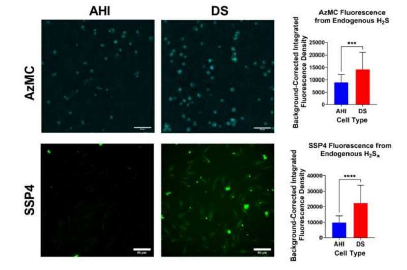 Carbon Nanomaterials Show Promise in Down Syndrome Treatment - Research Highlights