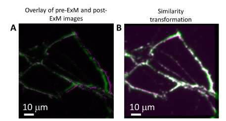 Enhanced Fluorescence Microscopy: Achieving Higher Resolution with Brighter Markers