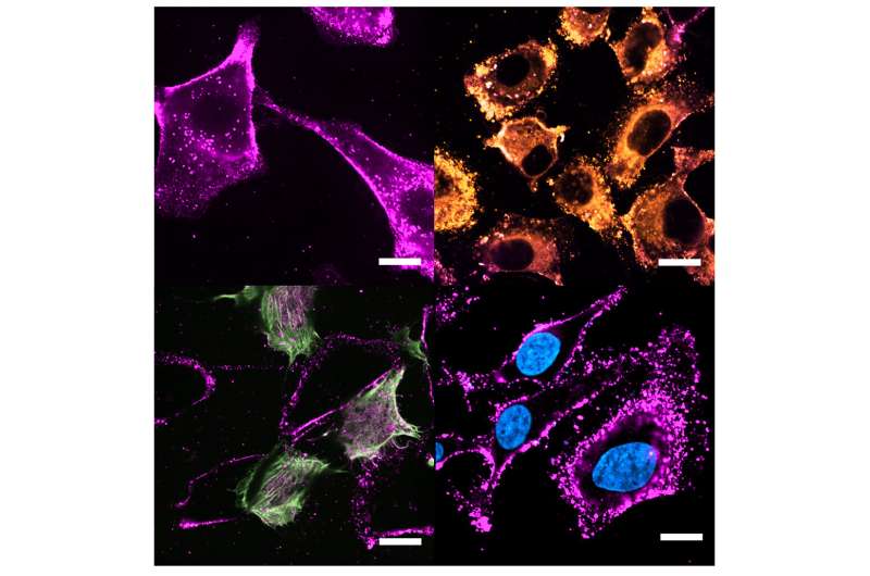 Cell-Derived Nanocarriers: Enhancing Intracellular Drug Delivery