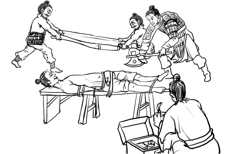 Ancient Amputation Rituals: Skeletal Remains Reveal Central China Practice