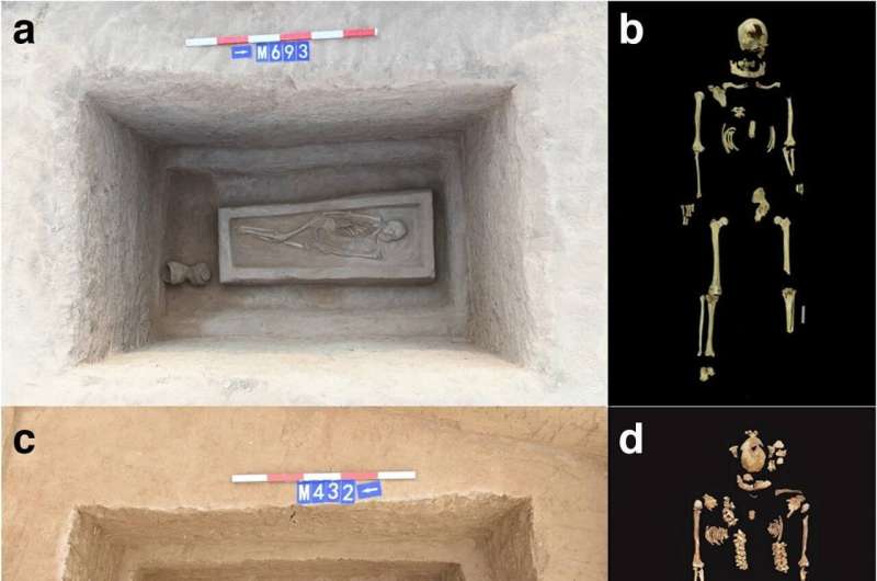 Ancient Amputation Rituals: Skeletal Remains Reveal Central China Practice