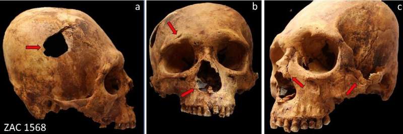 Ancient Peruvian Violence: New Study Reveals Evidence of Trauma During Crisis