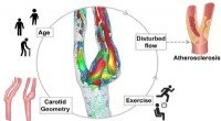 Simulating the Impact of Exercise, Age, and Carotid Geometry on Plaque Formation in Arteries